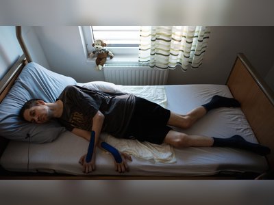 Dramatic Increase in ALS Cases in Hungary Revealed
